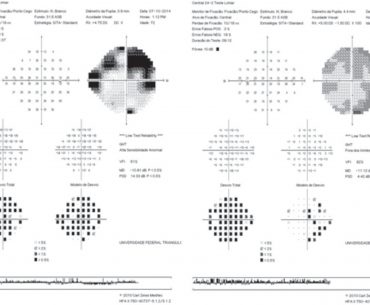 Exame de Campo Visual Humphrey